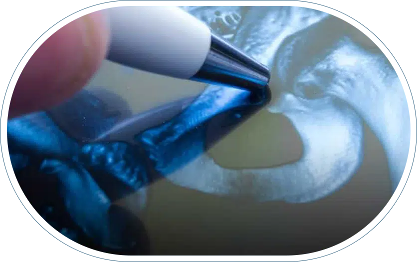 Best hip replacement surgeon pointing to an X-ray of a hip with a ballpoint pen.