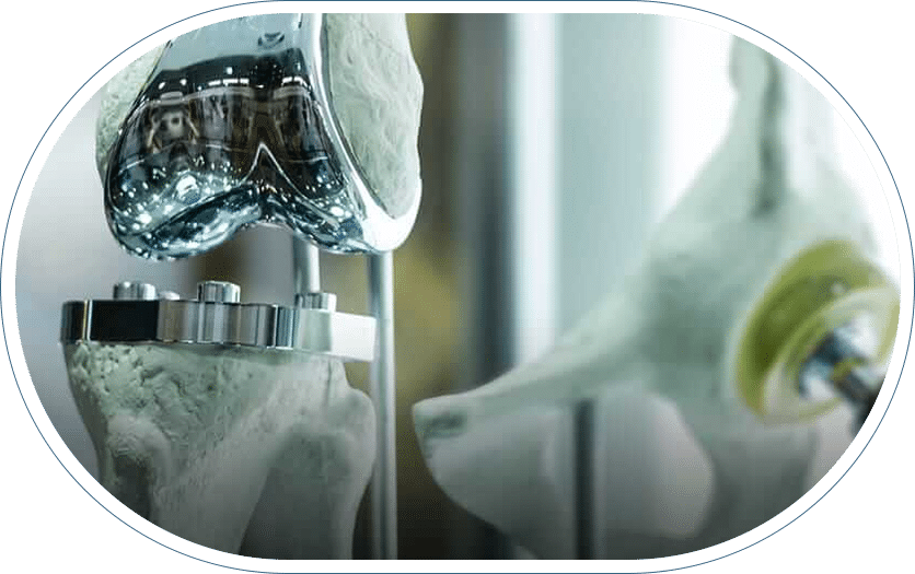 Knee replacement prosthetics in an orthopedic surgeon office.
