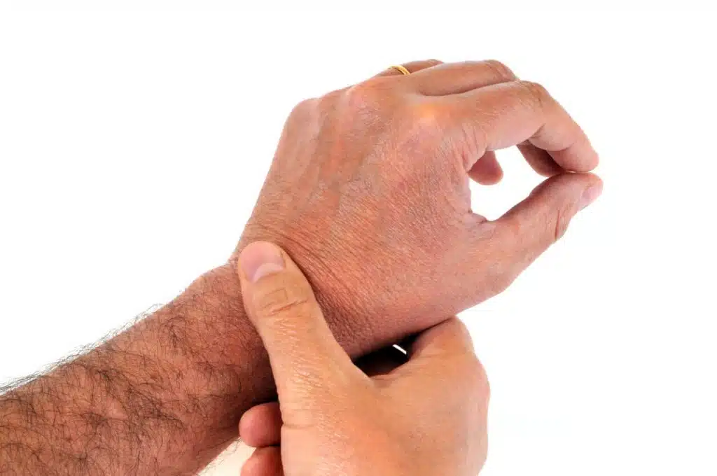 A man is holding his hand due to a condition that may be Dupuytren's contracture or trigger finger.