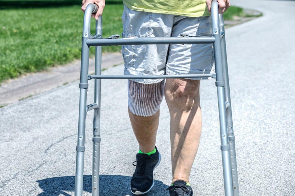 A patient is recovering from knee replacement surgery and is engaged in a walking exercise.