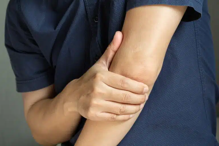 Man touching the elbow with tennis elbow pain And he relieves pain with massage.